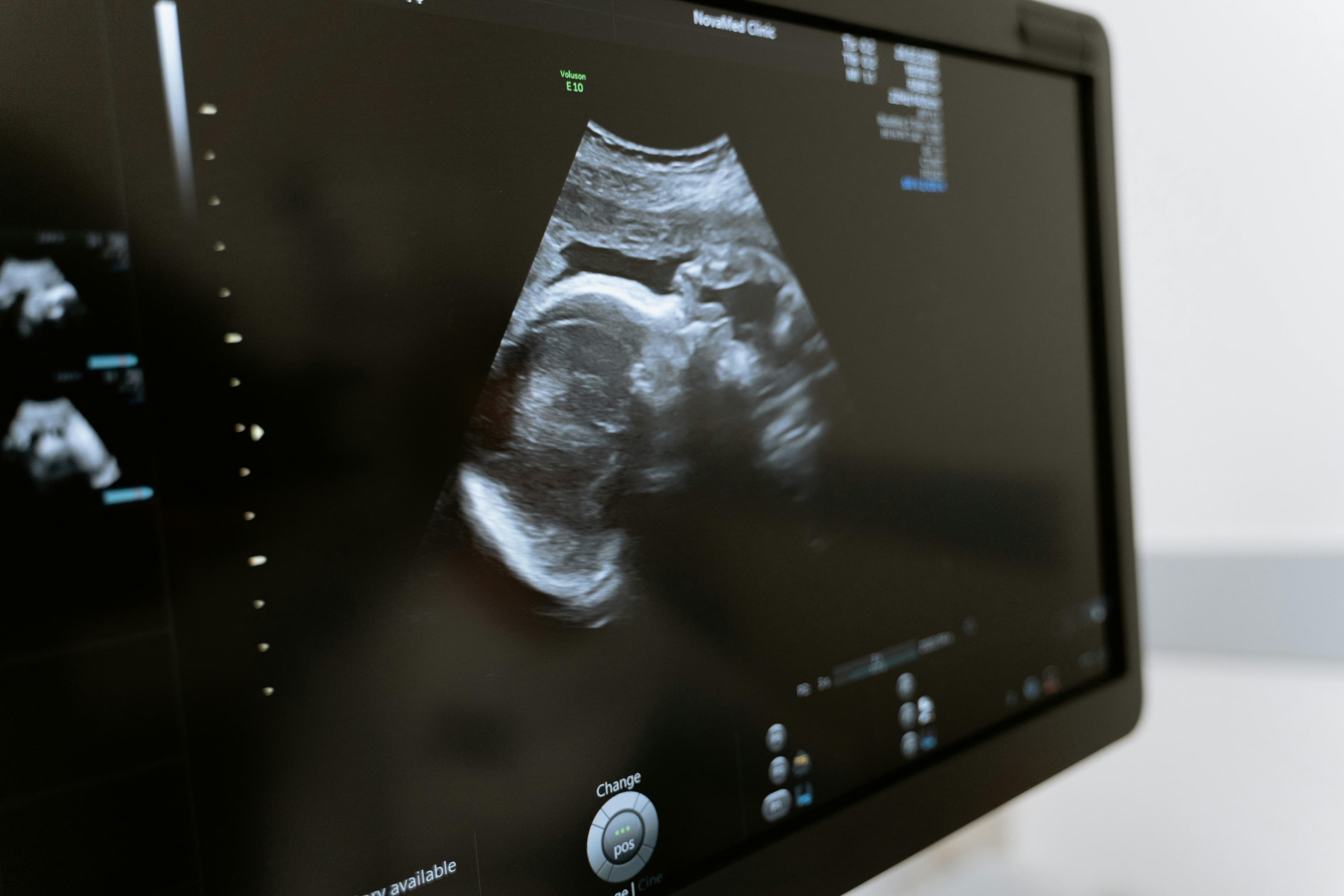 Advanced cardiac imaging technology